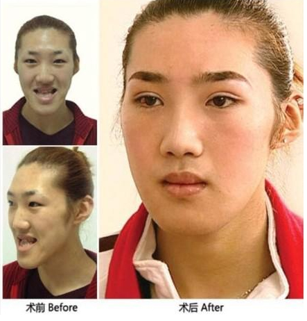 组图: 黄海波 嫖娼门 女主角 出生系男性 其母否