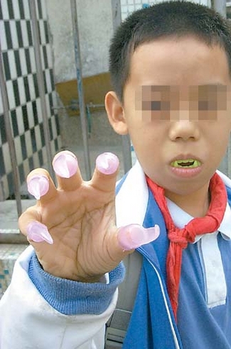 组图:八岁男变僵尸嚷着要吸血 喷狗血没用反被